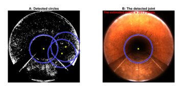 Image processing for automatic interpretation of drinking water mains inspections